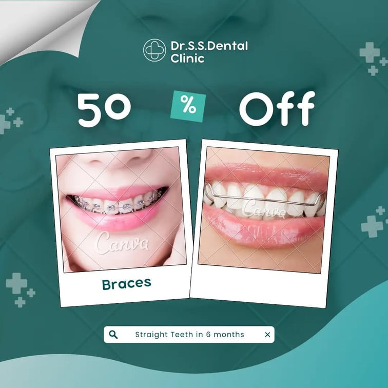 Teeth Clip Treatment Cost in Coimbatore Dental Clinic